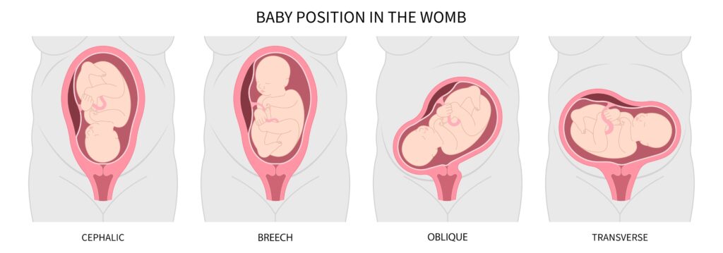 Baby Position