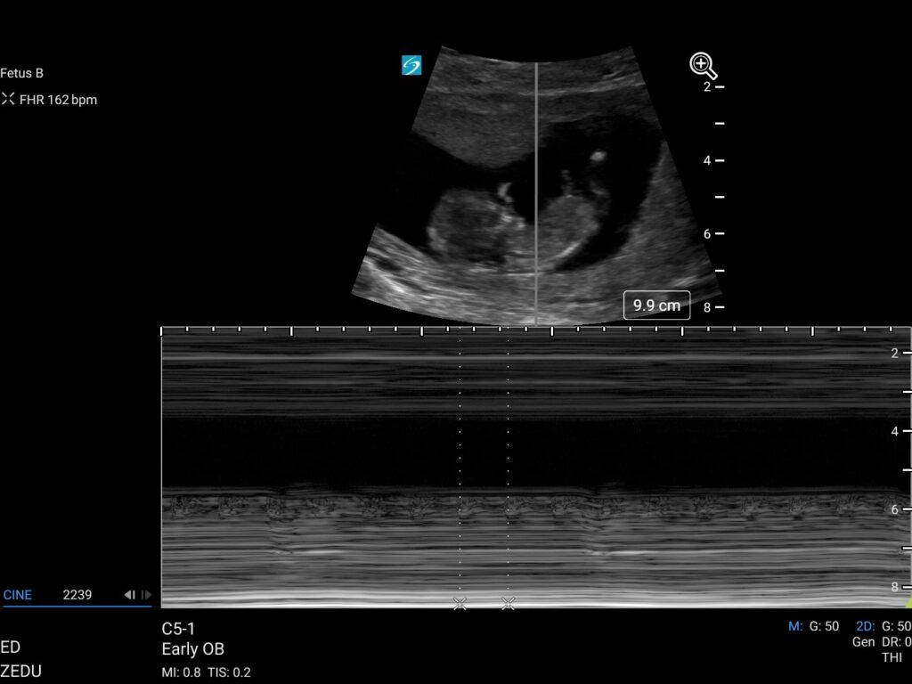 interpret findings