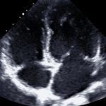 Focused Cardiac Ultrasound Course