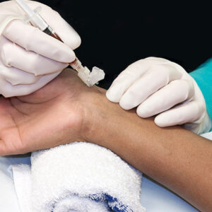 Zedu ultrasound guided Vascular Access