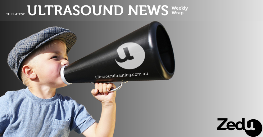 Zedu Ultrasound News - Weekly Wrap