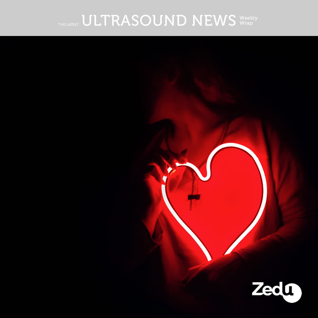 The Zedu weekly wrap - bringing together the best in free ultrasound news, views and opinions from across the internet.