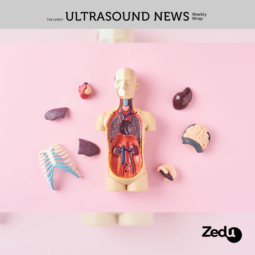 The Zedu weekly wrap - bringing together the best in free ultrasound news, views and opinions from across the internet.