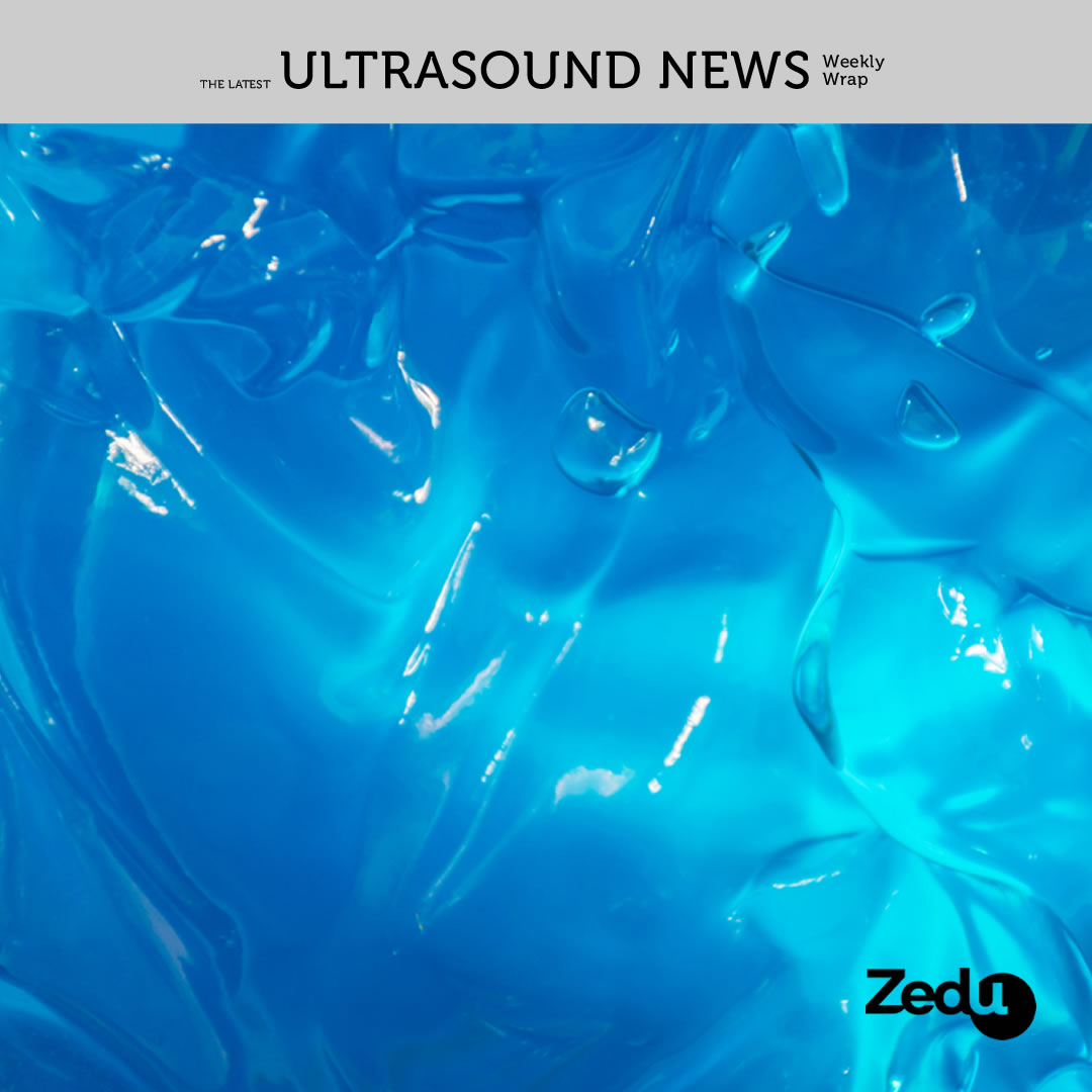 The Zedu weekly wrap - bringing together the best in free ultrasound news, views and opinions from across the internet.