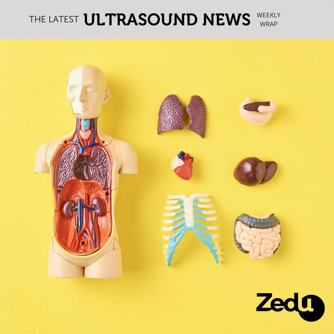 The Zedu weekly wrap - bringing together the best in free ultrasound news, views and opinions from across the internet.