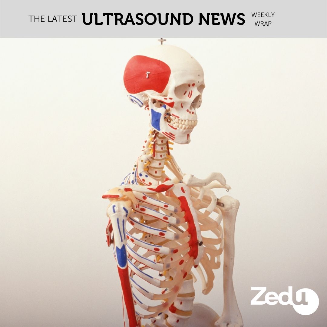 The Zedu weekly wrap - bringing together the best in free ultrasound news, views and opinions from across the internet.