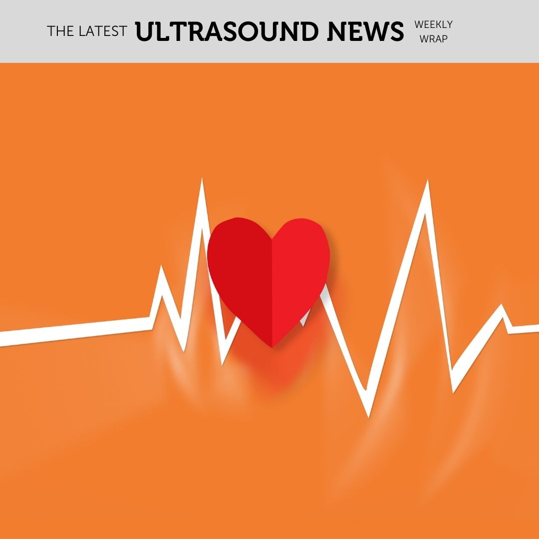The Zedu weekly wrap - bringing together the best in free ultrasound news, views and opinions from across the internet.