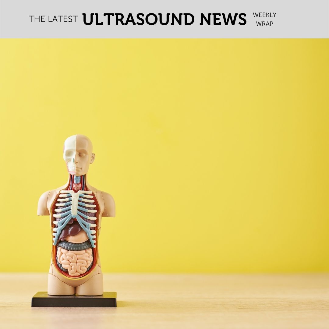 The Zedu weekly wrap - bringing together the best in free ultrasound news, views and opinions from across the internet.