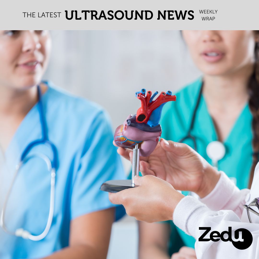 The Zedu weekly wrap - bringing together the best in free ultrasound news, views and opinions from across the internet.