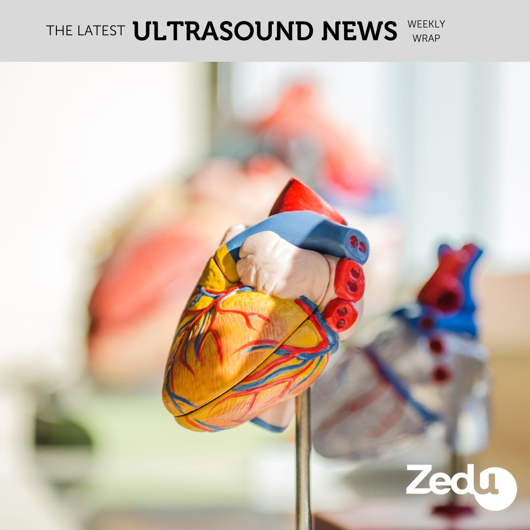 The Zedu weekly wrap - bringing together the best in free ultrasound news, views and opinions from across the internet.