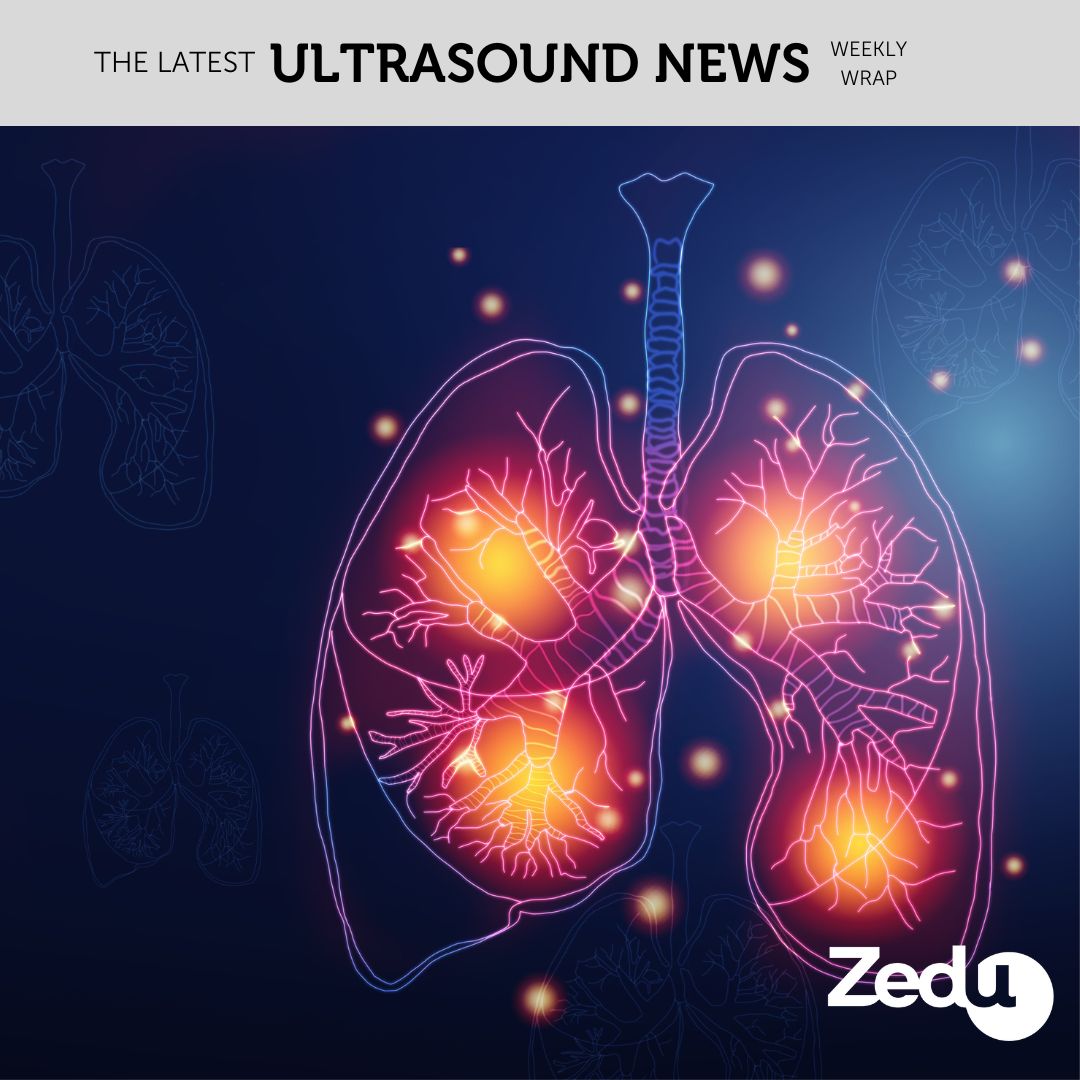The Zedu weekly wrap - bringing together the best in free ultrasound news, views and opinions from across the internet.