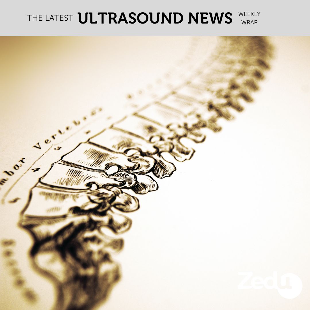 The Zedu weekly wrap - bringing together the best in free ultrasound news, views and opinions from across the internet.