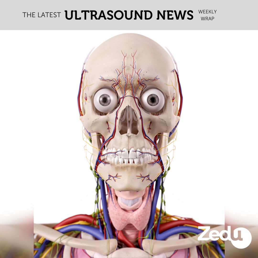 The Zedu weekly wrap - bringing together the best in free ultrasound news, views and opinions from across the internet.
