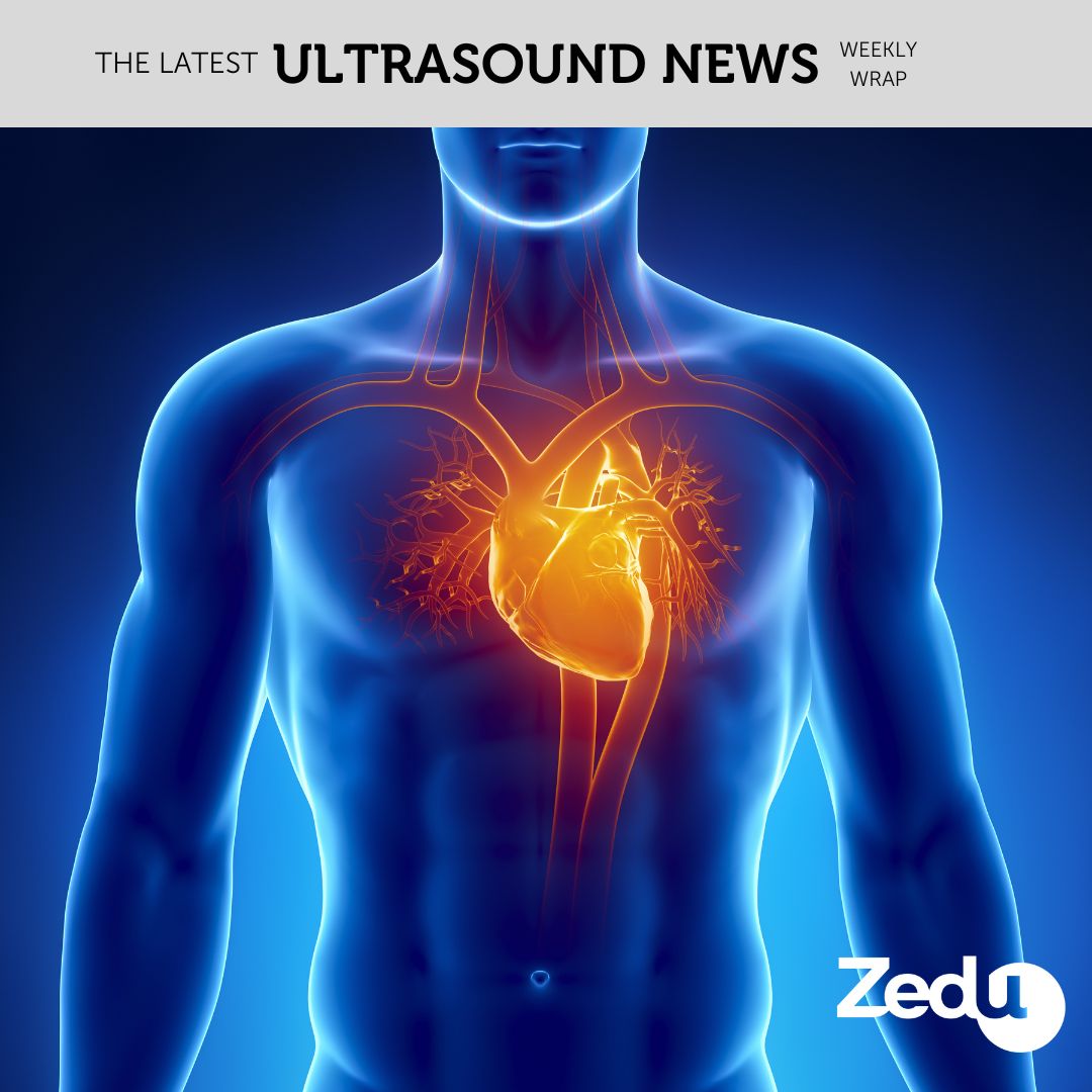 The Zedu weekly wrap - bringing together the best in free ultrasound news, views and opinions from across the internet.