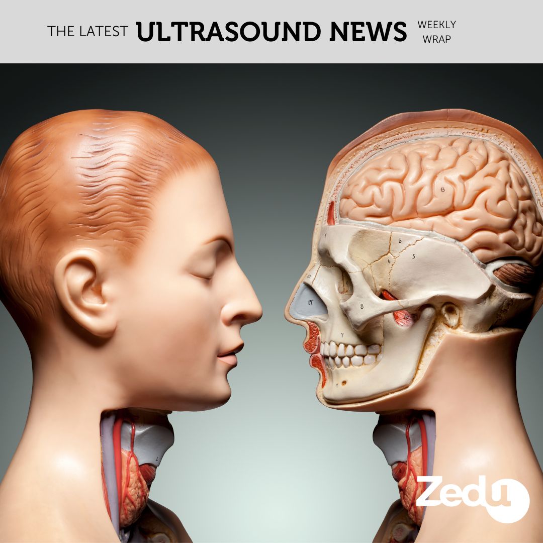 The Zedu weekly wrap - bringing together the best in free ultrasound news, views and opinions from across the internet.