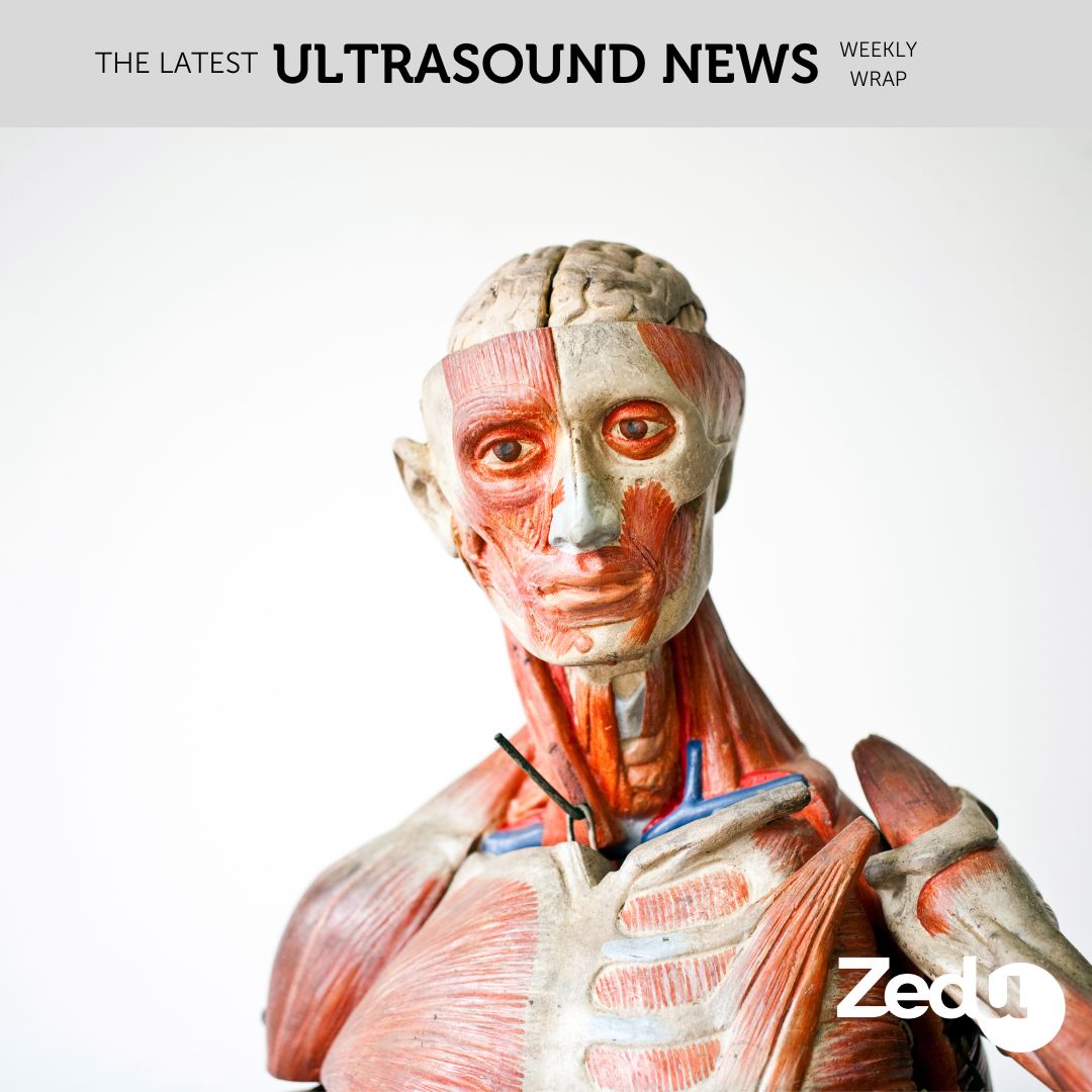 The Zedu weekly wrap - bringing together the best in free ultrasound news, views and opinions from across the internet.