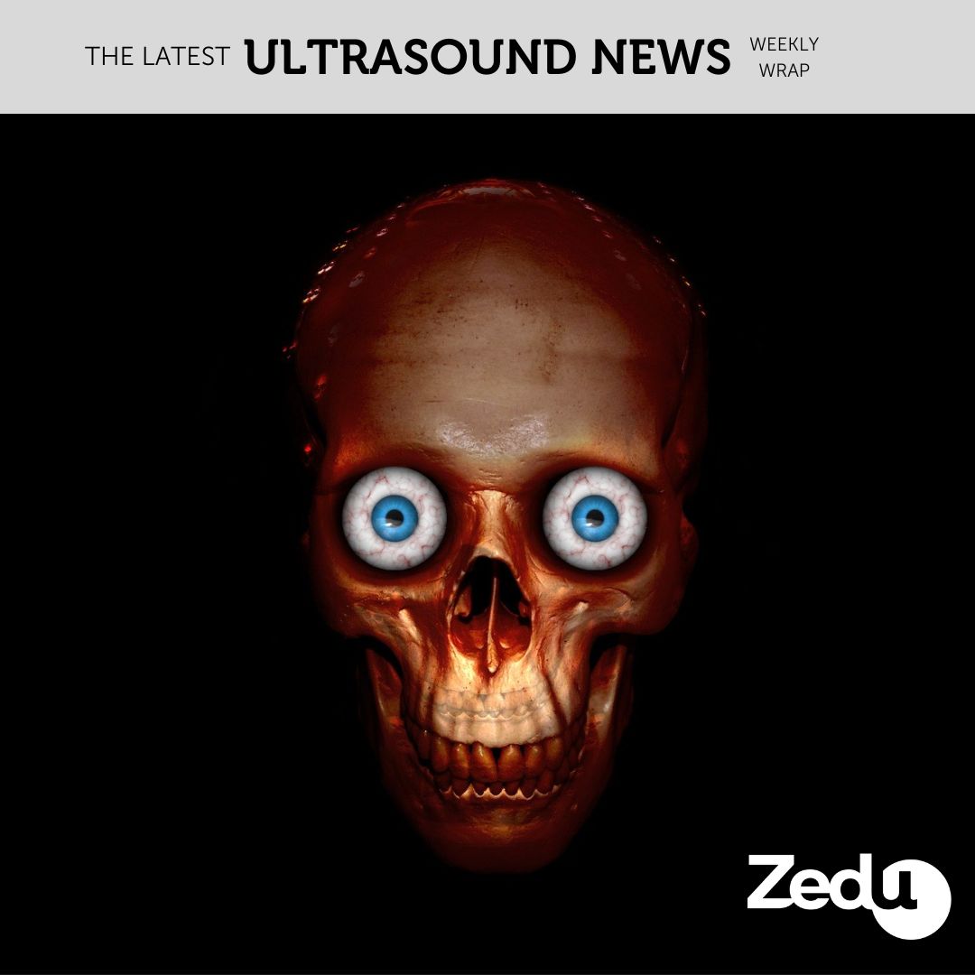 The Zedu weekly wrap - bringing together the best in free ultrasound news, views and opinions from across the internet.