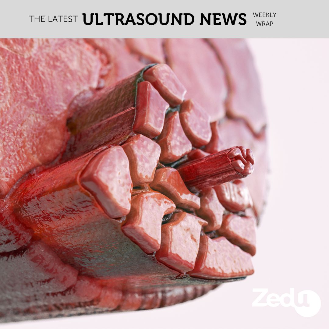 The Zedu weekly wrap - bringing together the best in free ultrasound news, views and opinions from across the internet.