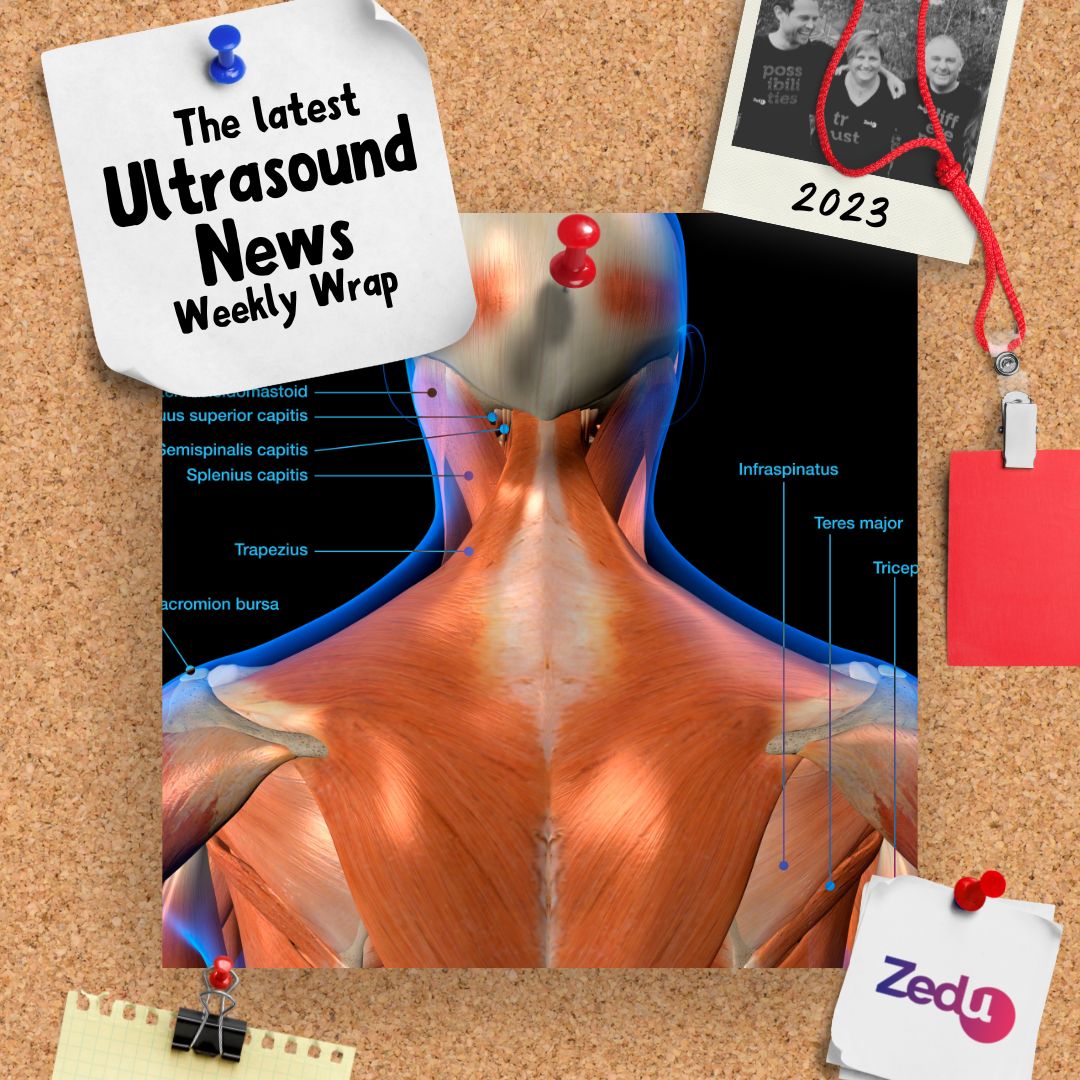 The Zedu weekly wrap - bringing together the best in free ultrasound news, views and opinions from across the internet.