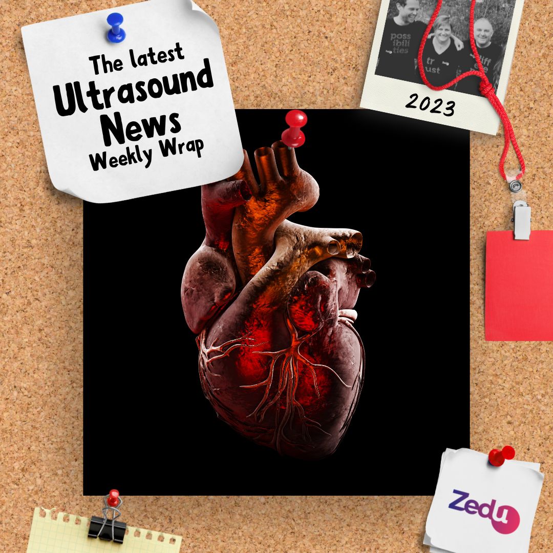 The Zedu weekly wrap - bringing together the best in free ultrasound news, views and opinions from across the internet.
