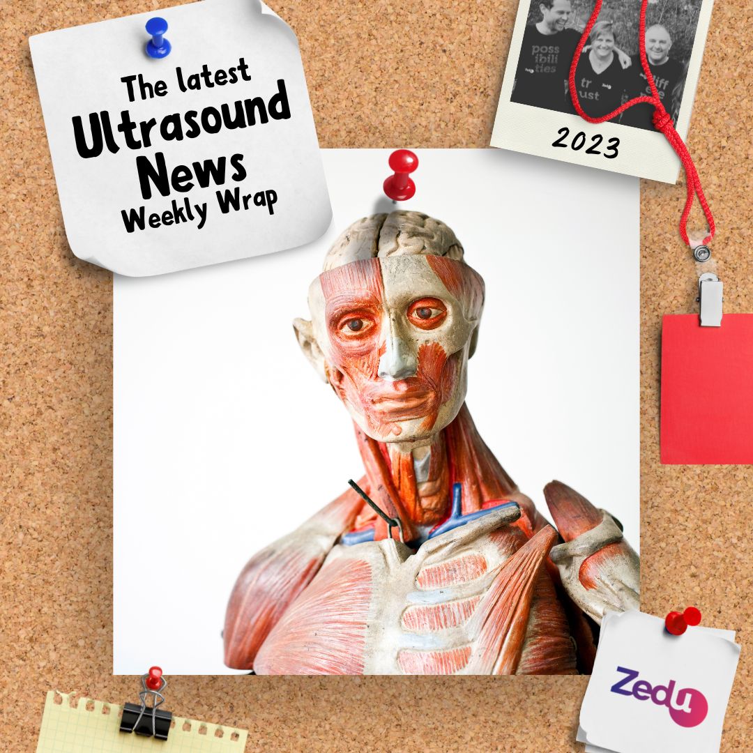The Zedu weekly wrap - bringing together the best in free ultrasound news, views and opinions from across the internet.