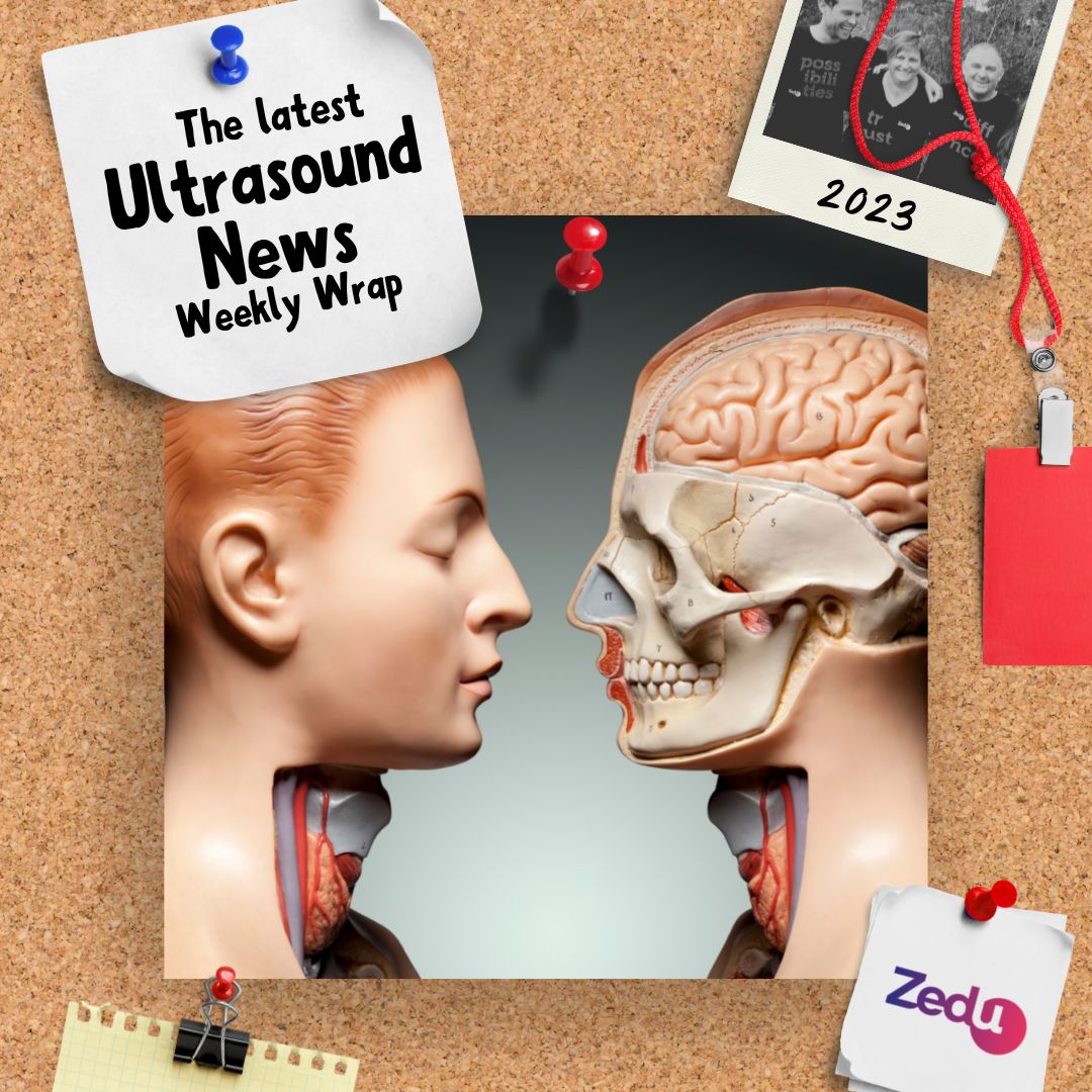 The Zedu weekly wrap - bringing together the best in free ultrasound news, views and opinions from across the internet.