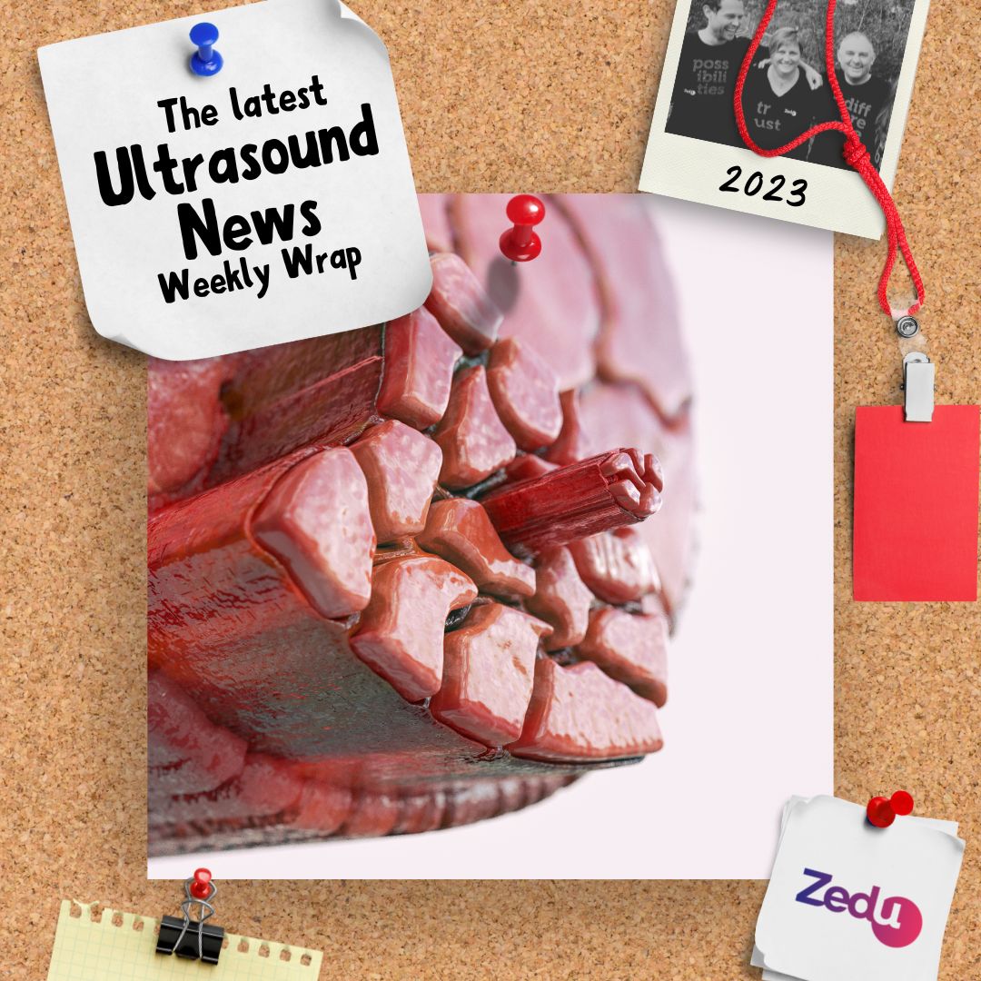The Zedu weekly wrap - bringing together the best in free ultrasound news, views and opinions from across the internet.