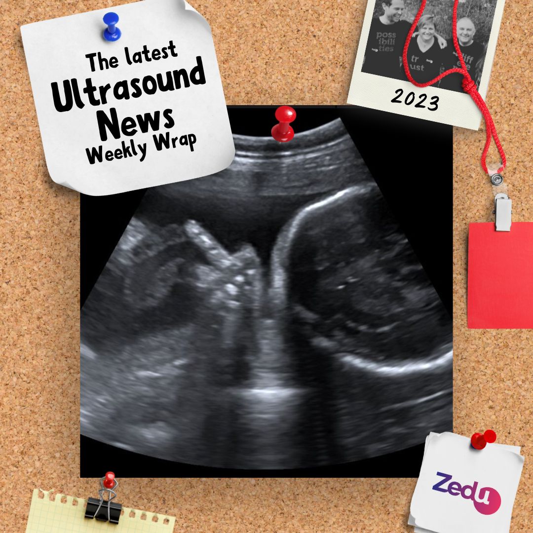 The Zedu weekly wrap - bringing together the best in free ultrasound news, views and opinions from across the internet.