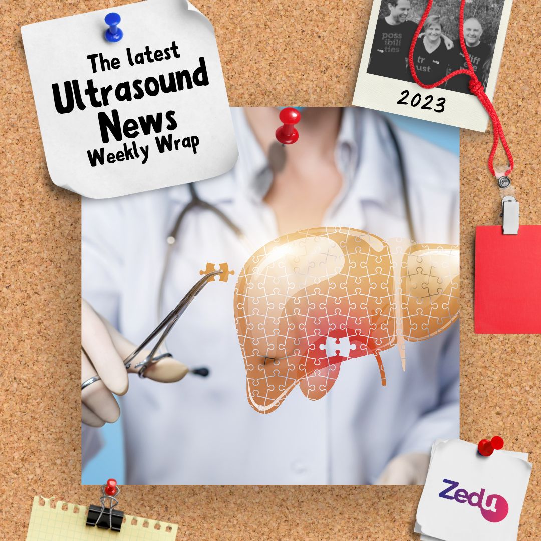 The Zedu weekly wrap - bringing together the best in free ultrasound news, views and opinions from across the internet.