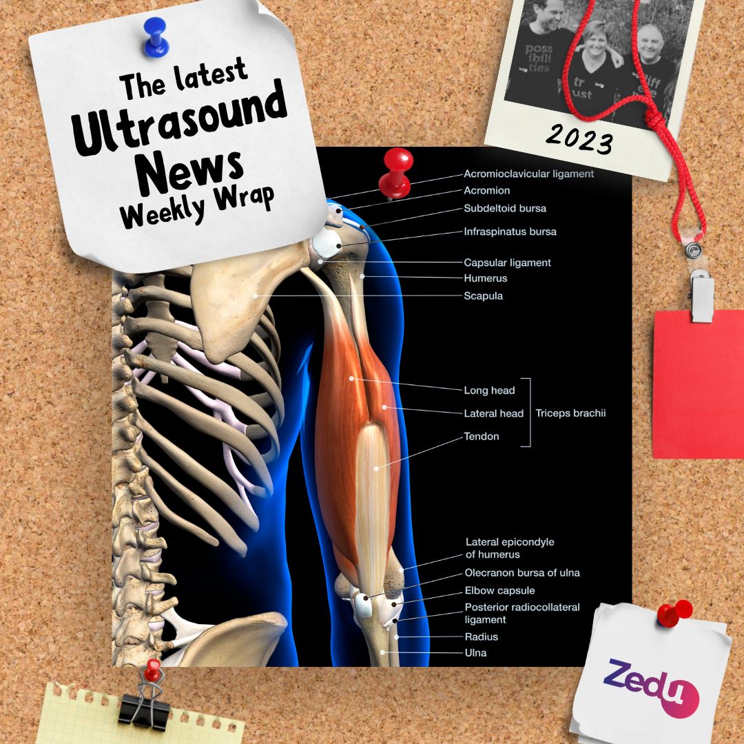 The Zedu weekly wrap - bringing together the best in free ultrasound news, views and opinions from across the internet.