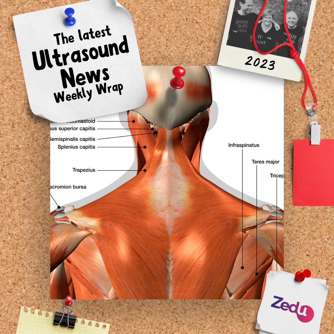 The Zedu weekly wrap - bringing together the best in free ultrasound news, views and opinions from across the internet.