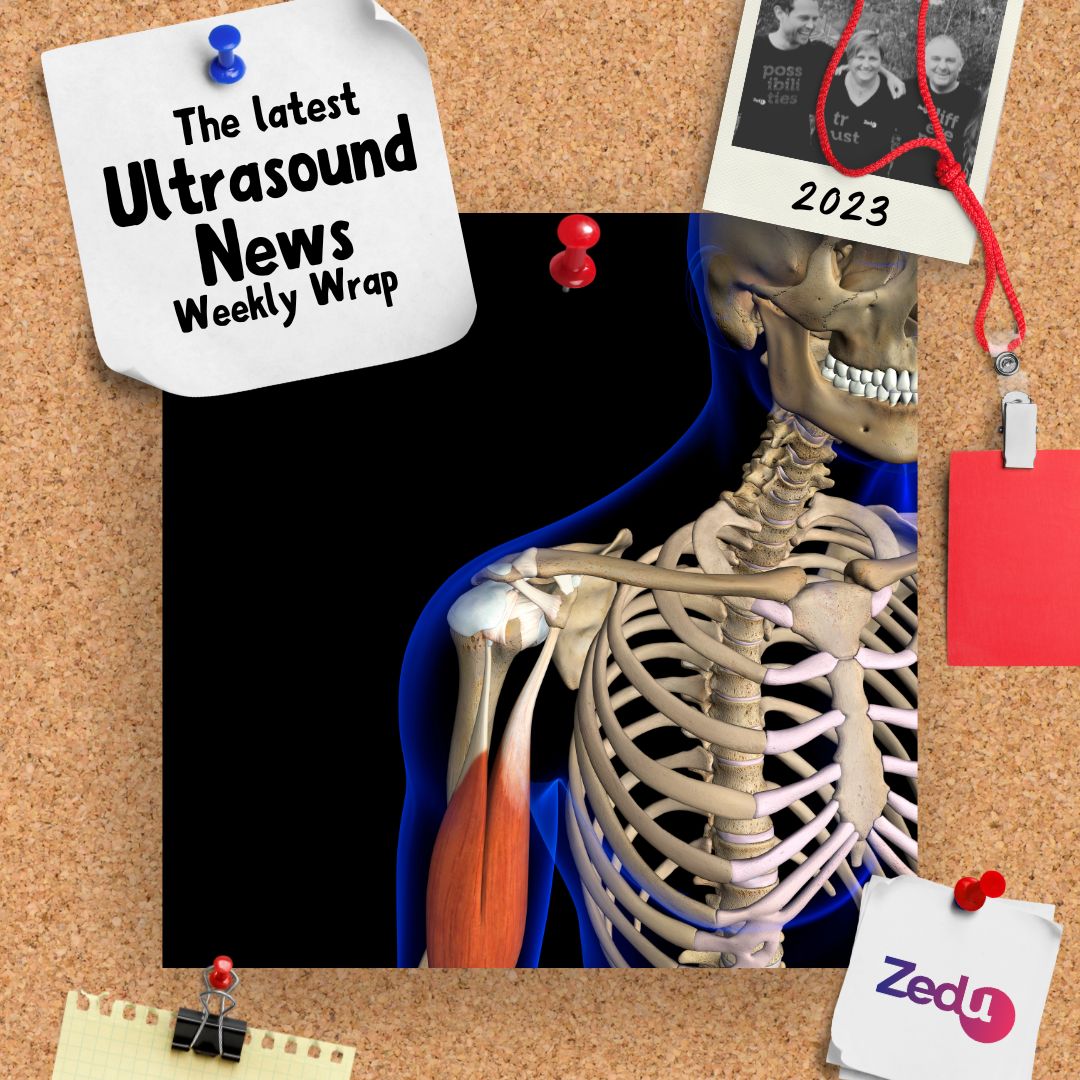 The Zedu weekly wrap - bringing together the best in free ultrasound news, views and opinions from across the internet.