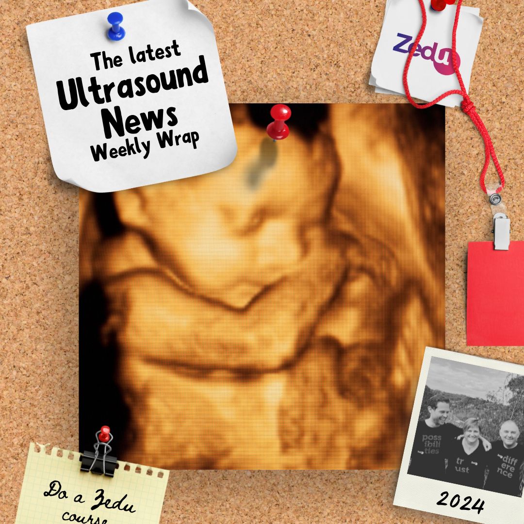 The Zedu weekly wrap - bringing together the best in free ultrasound news, views and opinions from across the internet.