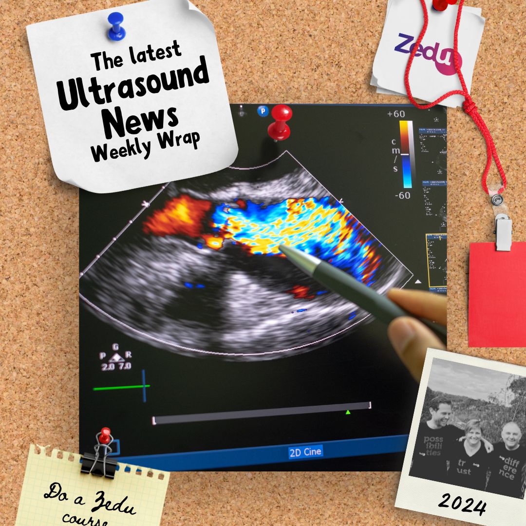 The Zedu weekly wrap - bringing together the best in free ultrasound news, views and opinions from across the internet.