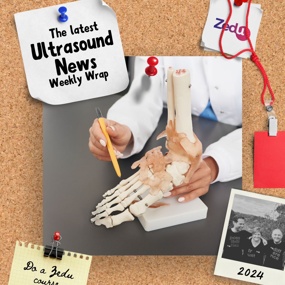The Zedu weekly wrap - bringing together the best in free ultrasound news, views and opinions from across the internet.