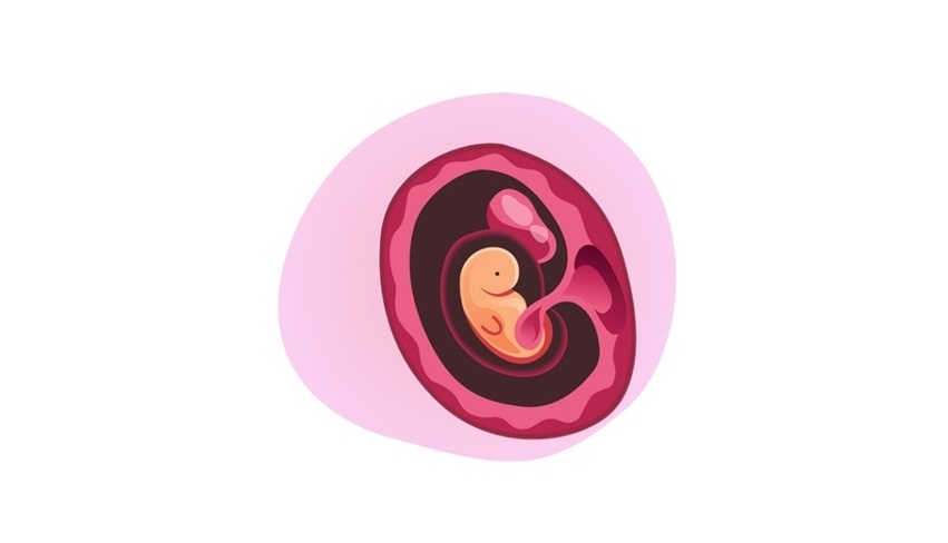 Early Pregnancy Assessment for Sonographers 2 days