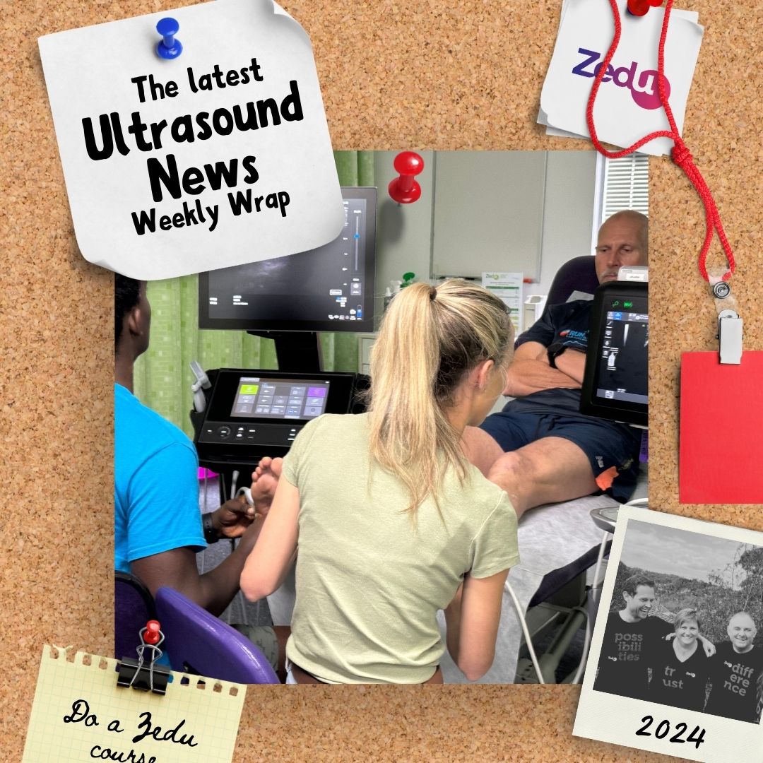 The Zedu weekly wrap - bringing together the best in free ultrasound news, views and opinions from across the internet.