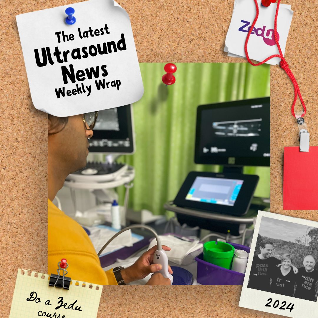 The Zedu weekly wrap - bringing together the best in free ultrasound news, views and opinions from across the internet.