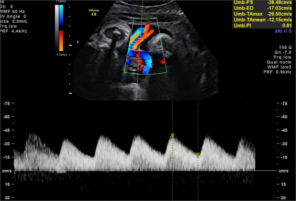 Why Ultrasound Matters