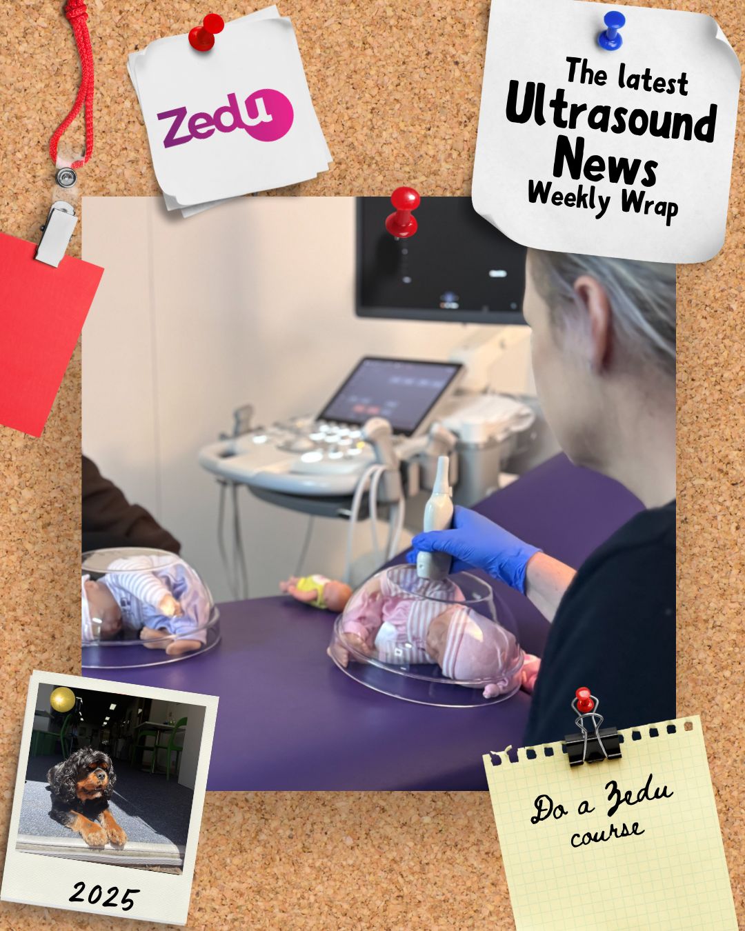 The Zedu weekly wrap - bringing together the best in free ultrasound news, views and opinions from across the internet.