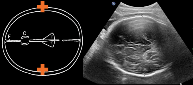 zedu fetal presentation critical care