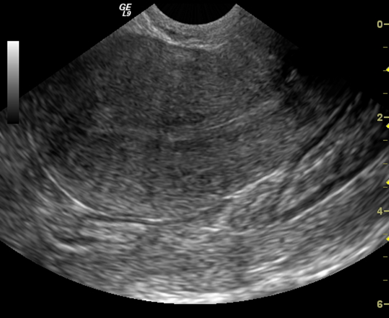 zedu major ultrasound focus women's health ultrasound