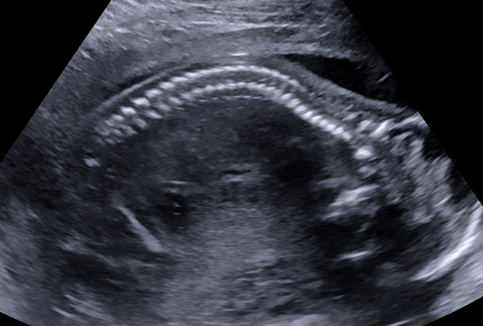 Zedu 2nd trimester ultrasound fast-track for sonographers middle cerebral artery