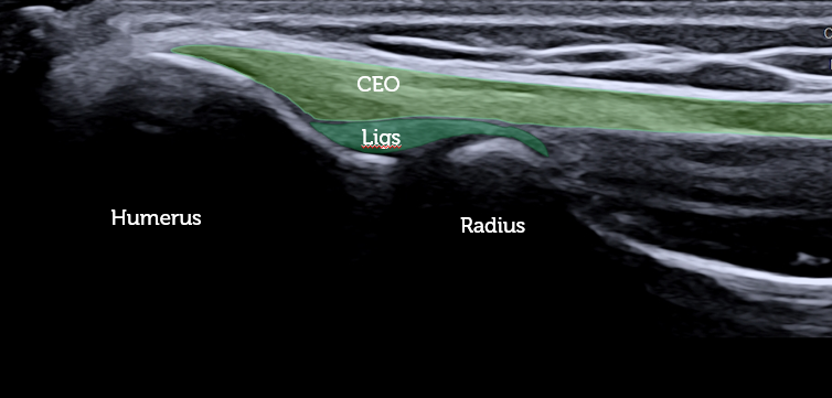 Zedu leg msk ultrasound