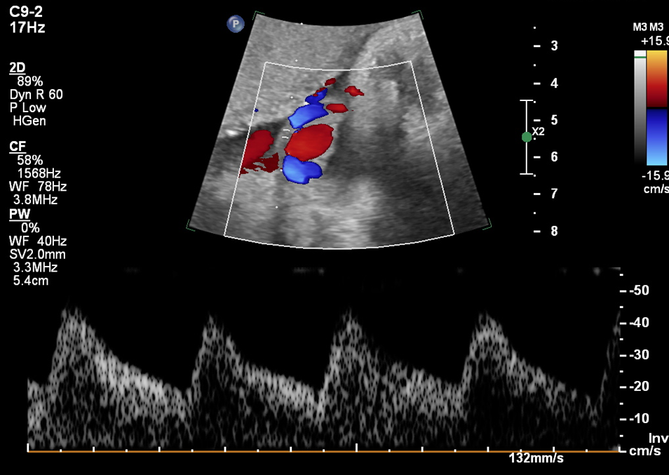 Zedu 3rd trimester obstetric ultrasound doppler examination training fast track course for sonographers