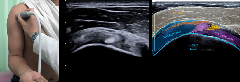 msk ultrasound