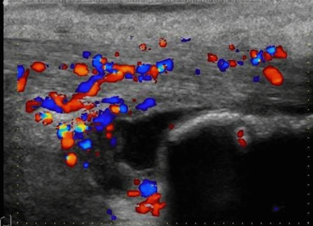 Zedu MSK ultrasound