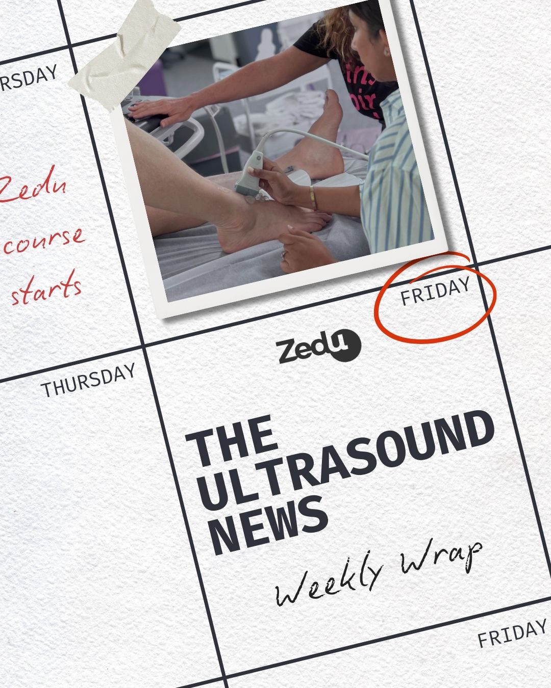 The Zedu weekly wrap - bringing together the best in free ultrasound news, views and opinions from across the internet.