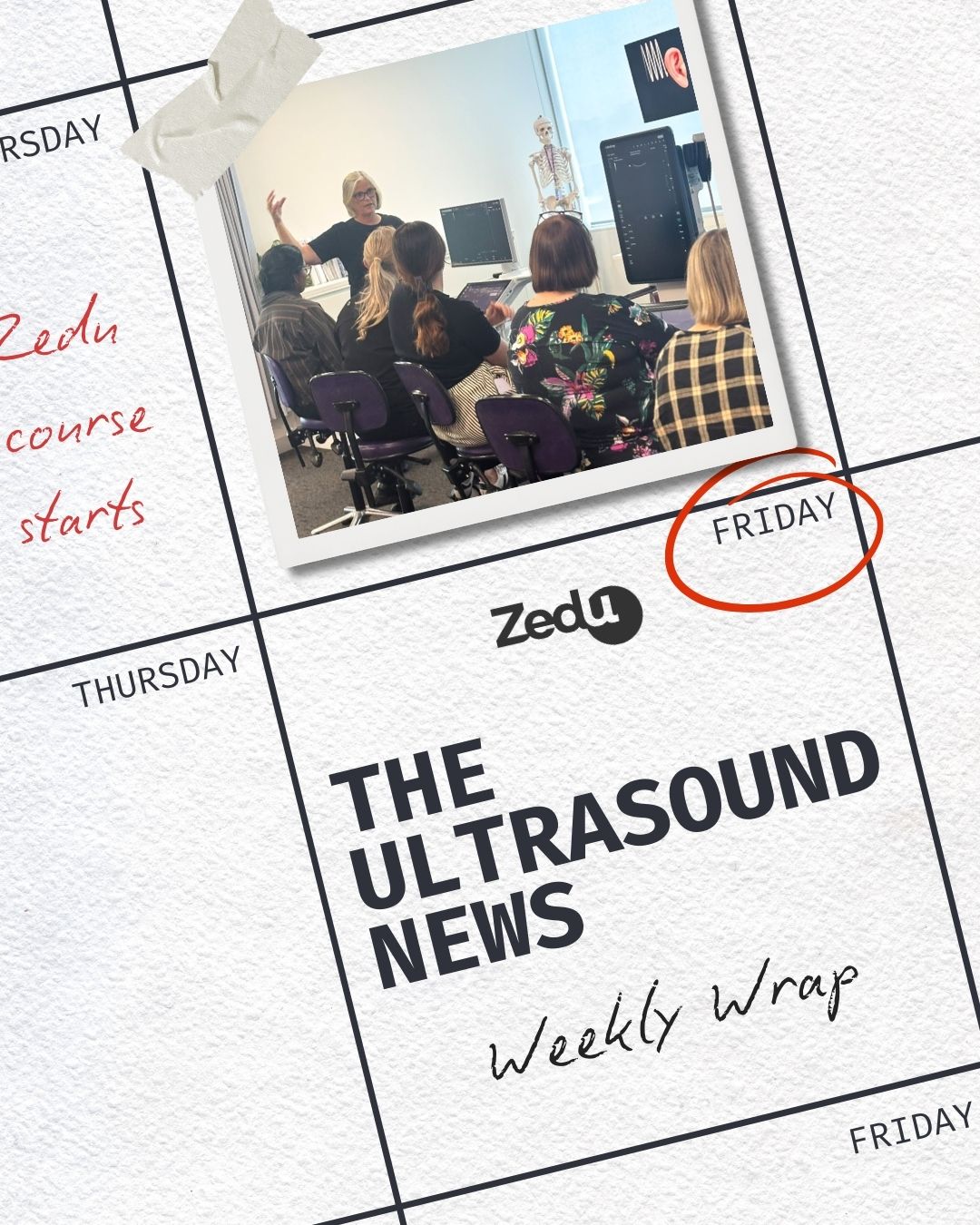 The Zedu weekly wrap - bringing together the best in free ultrasound news, views and opinions from across the internet.