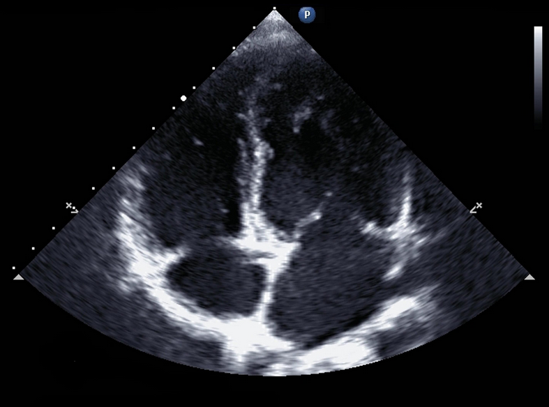 Why is learning ultrasound so important